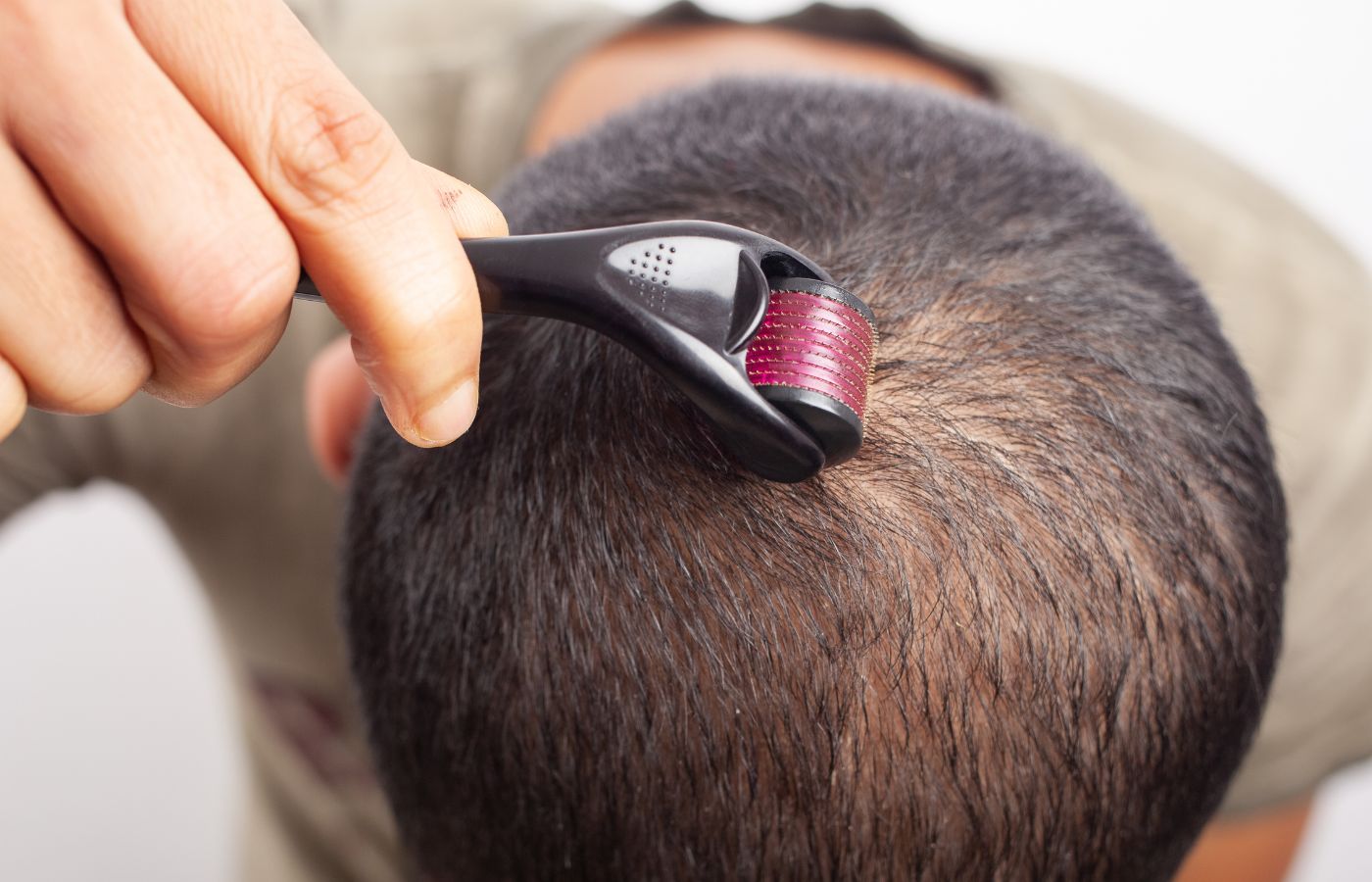 Microneedling barbe et cheveux : stimuler naturellement la pousse à domicile