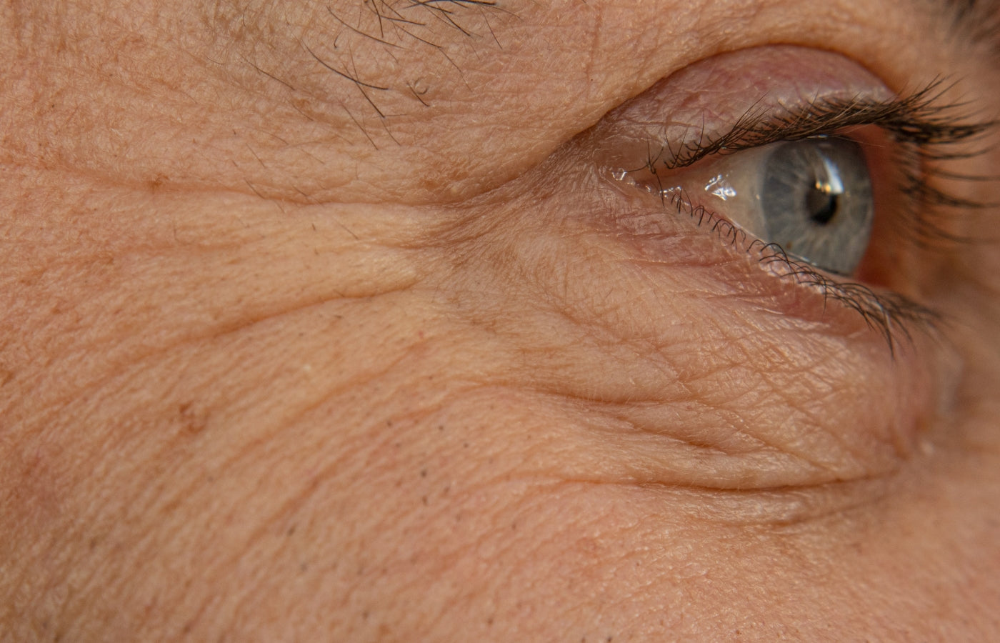 Microneedling et contour des yeux : peut-il atténuer les ridules et les pattes d'oie ?