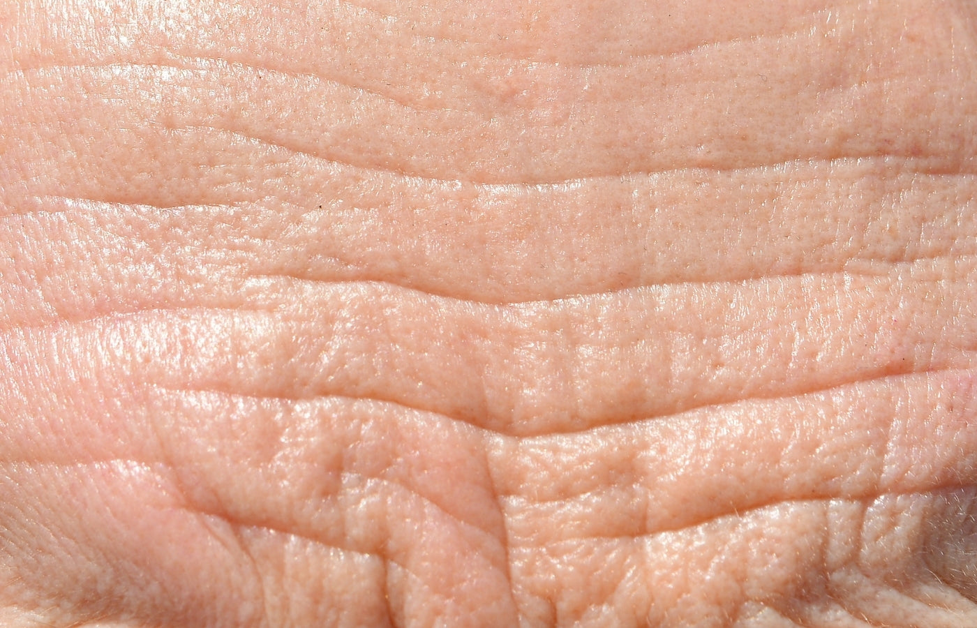 Microneedling et rides : comment atténuer visiblement les ridules et signes de l'âge ?