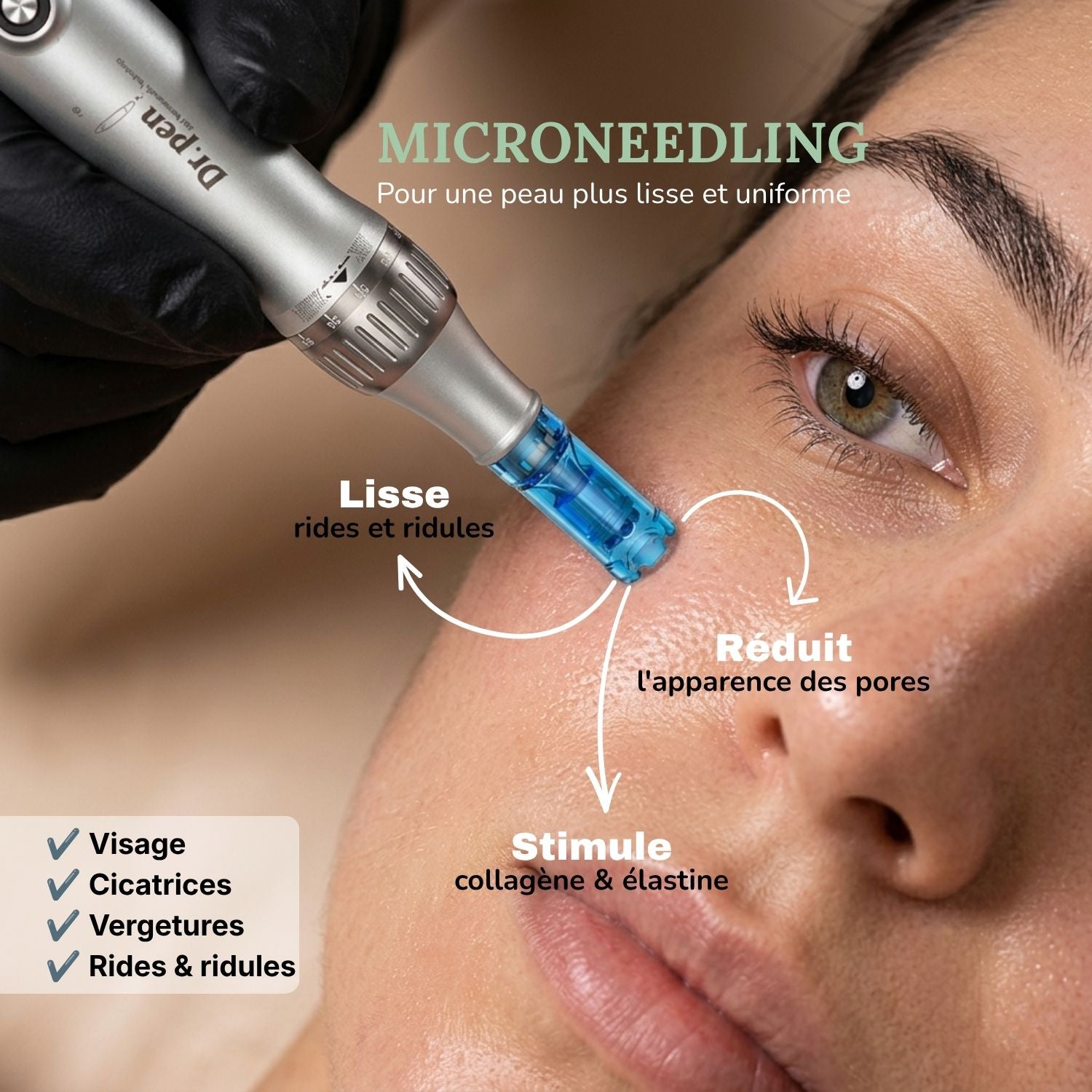 Kit Microneedling Expert™ – Tout-en-Un à Domicile